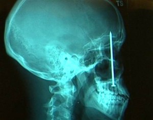 Сумасшедшие хирургические операции-1